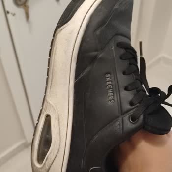 Skechers Ayakkabımda Erime Su Alma Ve Deri Soyulması Sorunu