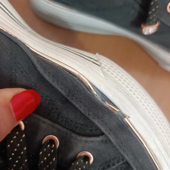 Skechers Ayakkabılarım Kısa Sürede Renk Atması Ve Yırtılma Yaşadı Hayal Kırıklığı