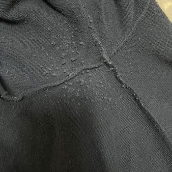 Mavi Eşofman Altındaki Hızlı Tüylenme, Erime Ve Renk Atması Şikayeti