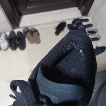 Adidas Superstar Ayakkabıda Erken Tiftiklenme Ve İade Seçeneği Eksikliği