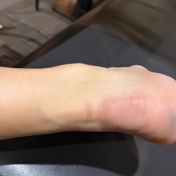 Ayakkabı Ayağımı Kesti, Mağaza Değişim Talebimi Reddetti