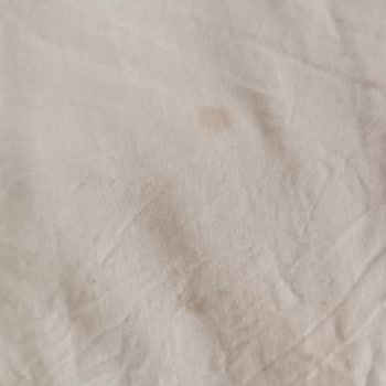 Makine Çıktığı Lekelerle Dolup Taşarken Cevapsız Servis