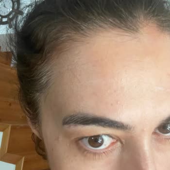 Bioderma Photoderm Spot 50 Faktör Güneş Kremi Yüzümde Şiddetli Sivilcelere Neden Oldu