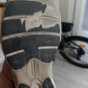 SuperStep Skechers Ayakkabısının Kısa Sürede Delinen Tabanı ve  Kullanıcı Hatası İddiası
