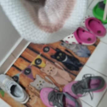 Skechers Slip-Ins Ayakkabısının Yarattığı Ağır Cilt Yaralanması Ve İlgisiz Müşteri Desteği