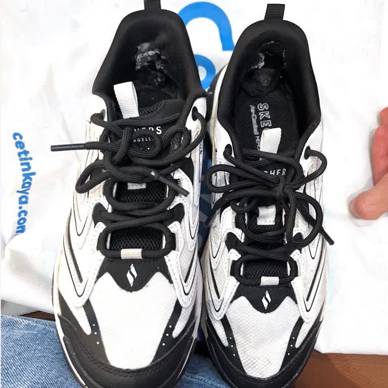Skechers Ayakkabısında Kısa Sürede Topuk Açılması Ve İade Talebi