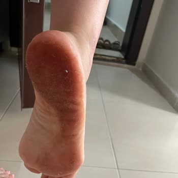 Boya Veren Terlikte Sağlık Riski Ve İade İsteği