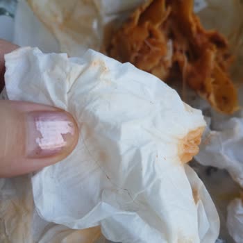 Hijyen Sorunu: Tavuk Döner Dürüme Kıl Düşmesi Ve Aşırı Peynir