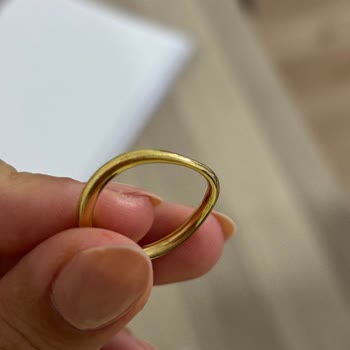 Pandora Yüzüğünün Çabuk Çürümesi Ve Trendyol’un Yardımsızlığı