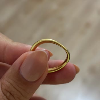 Pandora Yüzüğünün Çabuk Çürümesi Ve Trendyol’un Yardımsızlığı