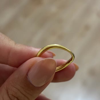 Pandora Yüzüğünün Çabuk Çürümesi Ve Trendyol’un Yardımsızlığı