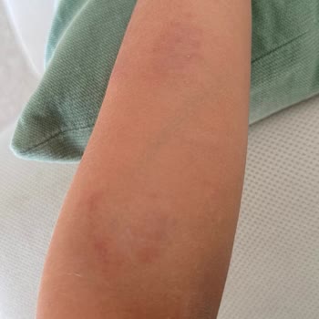Okulda Çocuğuma Uygulanan Şiddet Ve Yönetimin İlgisiz Tutumu