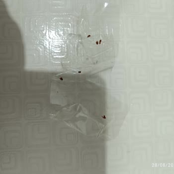 Baby Turco Bebek Bezinde Böcek Benzeri Parçalar Ve Hijyen Endişesi