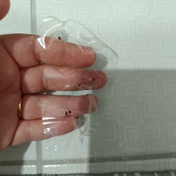 Baby Turco Bebek Bezinde Böcek Benzeri Parçalar Ve Hijyen Endişesi