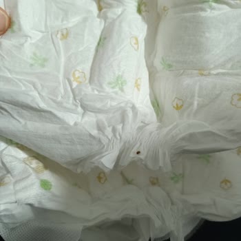 Baby Turco Bebek Bezinde Böcek Benzeri Parçalar Ve Hijyen Endişesi