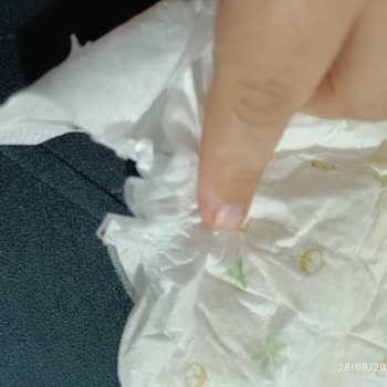 Baby Turco Bebek Bezinde Böcek Benzeri Parçalar Ve Hijyen Endişesi