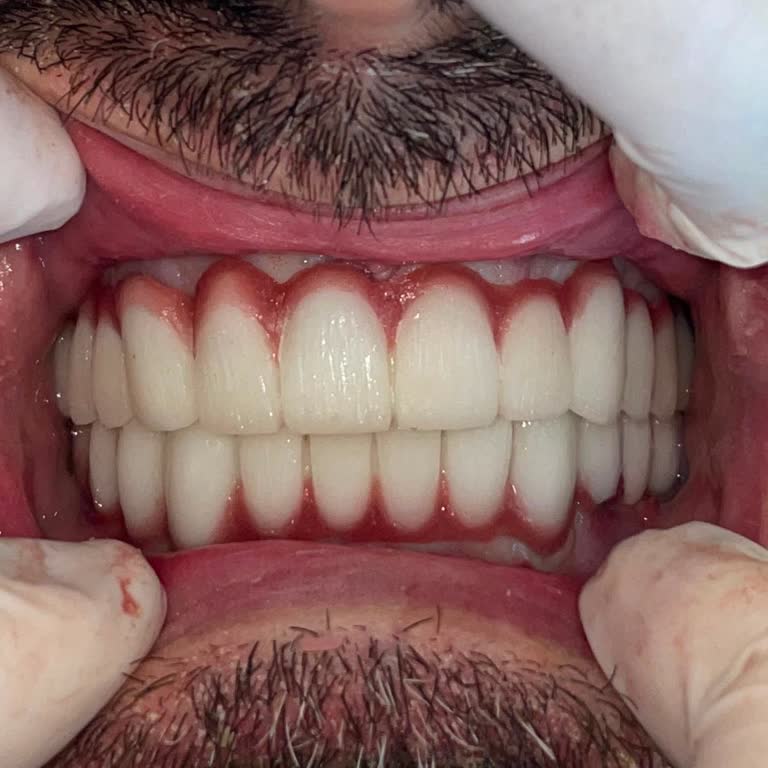 Dentacenter Başlarından Savdılar