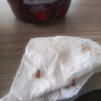 Torku Banada Kremasında Sert Yabancı Cisim Ve Sağlık Riski