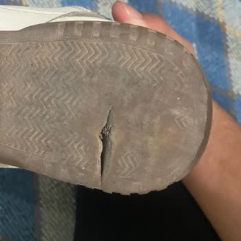 Ayakkabımın Kırılan Tabanı Garanti Kapsamında Olmalı