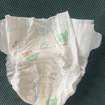 Prima Aktif Bebek Bezinde Alerjik Reaksiyon Ve İade Talebi