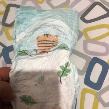 Kalitesiz Prima Bebek Bezi Bebeğimin Cildini Tahriş Ediyor