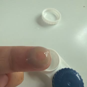 Labella Kontakt Lensinde Şiddetli Yanma Ve Değişim Talebi