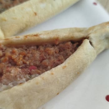 Hijyen İhlali Ve Saçlı Pide Üzerine İade Talebi
