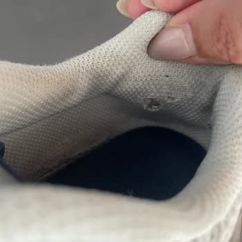 Yeni Aldığım New Balance Ayakkabının Kısa Sürede Yırtılması Ve Topuk Yaralanması