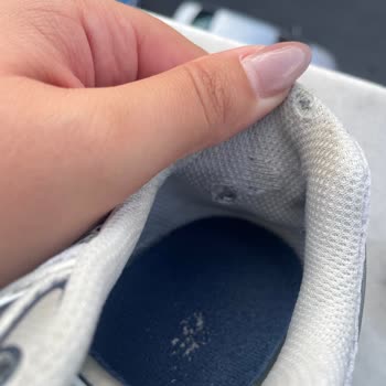 Yeni Aldığım New Balance Ayakkabının Kısa Sürede Yırtılması Ve Topuk Yaralanması