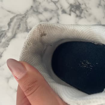 Yeni Aldığım New Balance Ayakkabının Kısa Sürede Yırtılması Ve Topuk Yaralanması