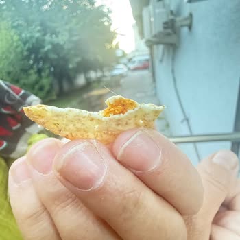 Ülker Altınbaşak Cipsinde Kıl: Hijyen Ve Sağlık Sorunu