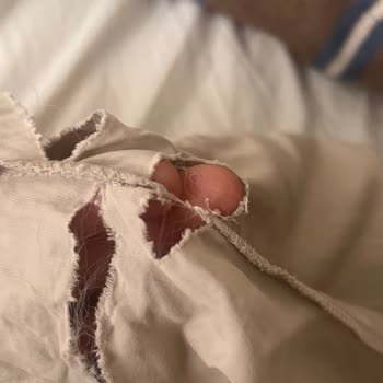 Yeni Pantolon Dikişinde Şiddetli Yırtılma Ve Üretim Hatası