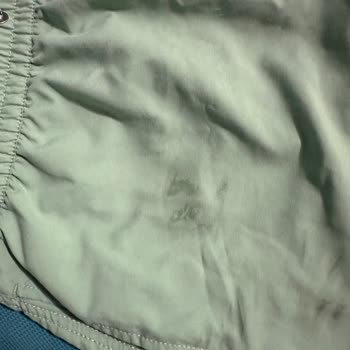Billabong Şortu Leke Nedeniyle Ret Kararı Ve İade Talebi