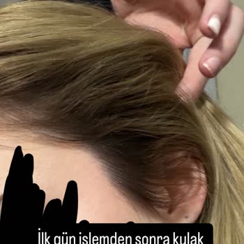 DMR Hair Studio’da Yanlış Renk, Alerjik Reaksiyon Ve İade Talebi