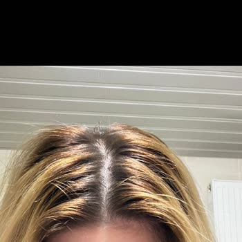 DMR Hair Studio’da Yanlış Renk, Alerjik Reaksiyon Ve İade Talebi