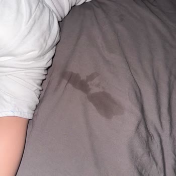Prima Premium Care Bebek Bezinde Sızdırma Ve Değişim Talebi