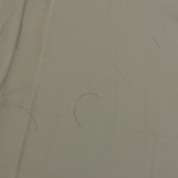 Best Western Brussels South Otelinde Hijyen Eksikliği Ve Şiddet Tehdidi