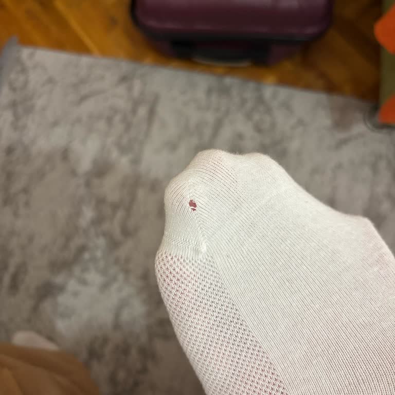 Penti Snaker Çorapta Açılışta Delik Ve Kırmızı Leke