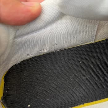Adidas Ayakkabıda Açılma Ve Yırtılma Garanti Sürecinde Reddedildi