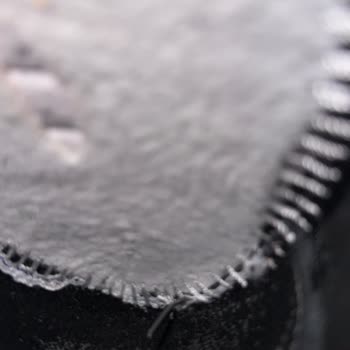 Ayakkabıda Çivi Çıktı, Büyük Parmağım Yaralandı Ve Şirket Alaycı Davrandı
