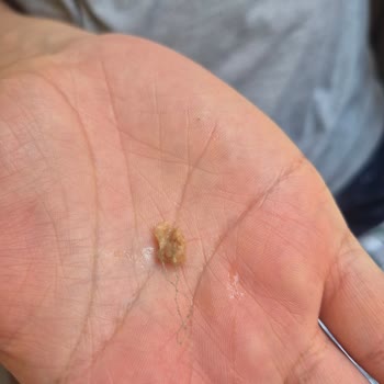 Bebek İçin Aldığım Kıyma İçinde Kıl Ve Yeşil İp Bulunması