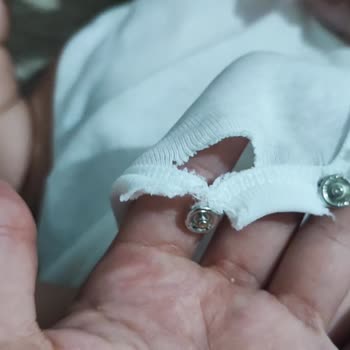 Hello Baby Zıbının İlk Yıkamada Yırtılması Ve Kalite Şikayeti