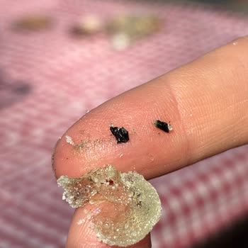 Ülker Lokumcuk’ta Siyah Plastik Parça: Çocuklar İçin Sağlık Riski