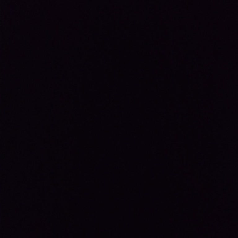 Burun Estetiği Sonrası Burun Ucunun Aşırı Düşmesi Ve Doktorun Yetersiz Açıklaması