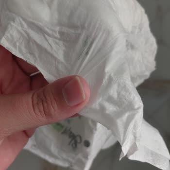 Sık Sızdıran Bebek Bezi Ve Düzensiz Pamuk Dağılımı Nedeniyle Pişik Ve Mağduriyet