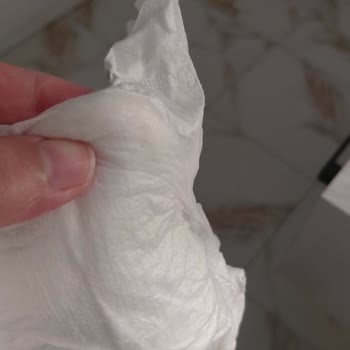 Sık Sızdıran Bebek Bezi Ve Düzensiz Pamuk Dağılımı Nedeniyle Pişik Ve Mağduriyet