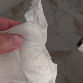 Sık Sızdıran Bebek Bezi Ve Düzensiz Pamuk Dağılımı Nedeniyle Pişik Ve Mağduriyet