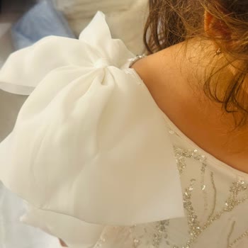 Kargosu Geciken Ve Patlamış Fermuarlı Kız Çocuk Elbisesi İçin Tam İade Talebi