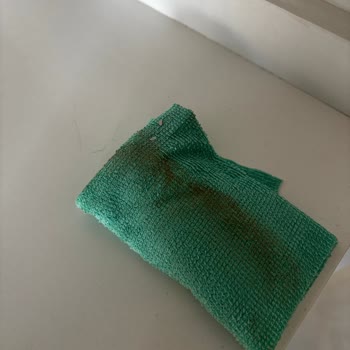 Temizlik Hizmetinde Yaşanan Sorun ve Tazminat Talebi