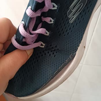 Skechers Ayakkabımın Çoraplık Ve Alt Kısmı Kısa Sürede Yırtıldı, Garanti Reddedildi
